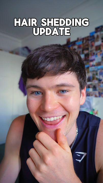 Download lagu Finasteride shedding update! 🚨 #hairloss #shedding