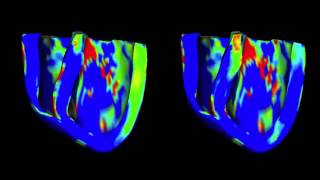 Computational Models of the Heart from Johns Hopkins University