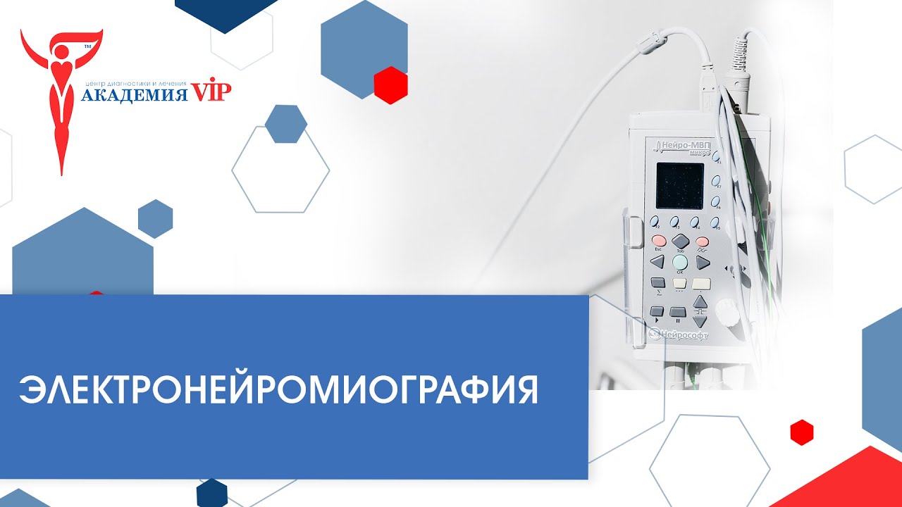 Электронейромиография