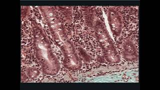 Digestive System Histology - Crypts of Lieberkuhn and stem cell division