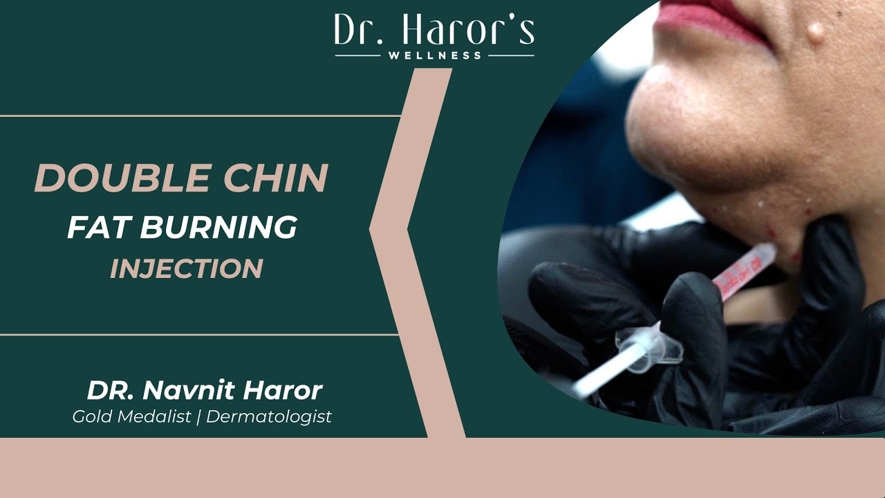 Double Chin Treatment | Best Dermatologist in Delhi Explains