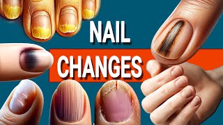 13 Nail Changes and What They Mean for Your Health