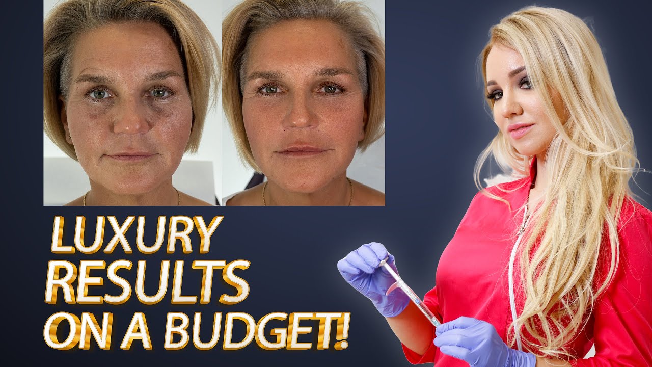 Luxury Results on a Budget Affordable Dermal Fillers Revealed! YouTube