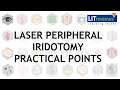 Laser Peripheral Iridotomy Practical Point