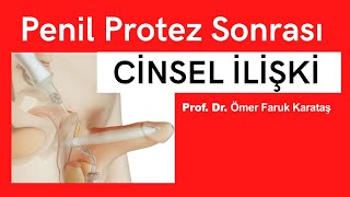 Penil Protez Ameliyatından Sonra Cinsel İlişki - Prof. Dr. Ömer Faruk Karataş