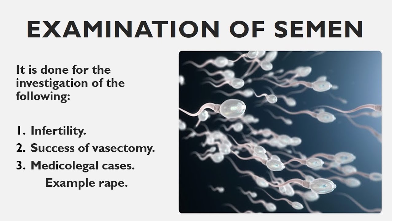 Examination of Semen Semen Lab Test Semen Result Lab Notes