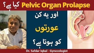 Pelvic Organ Prolapse Kya Hai? In Urdu/Hindi | Pelvic Organ Prolapse Treatment screenshot 2