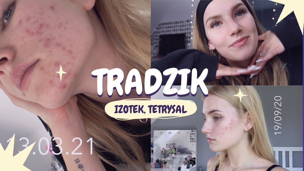 Trądzik: IZOTEK, TETRYSAL