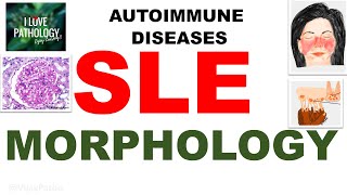 Autoimmune diseases |Part 5| Systemic Lupus Erythematosus |MORPHOLOGY by ilovepathology 298 views 9 days ago 13 minutes, 44 seconds