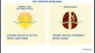Mastering the eFAST Ultrasound Exam: A 5-Step Guide