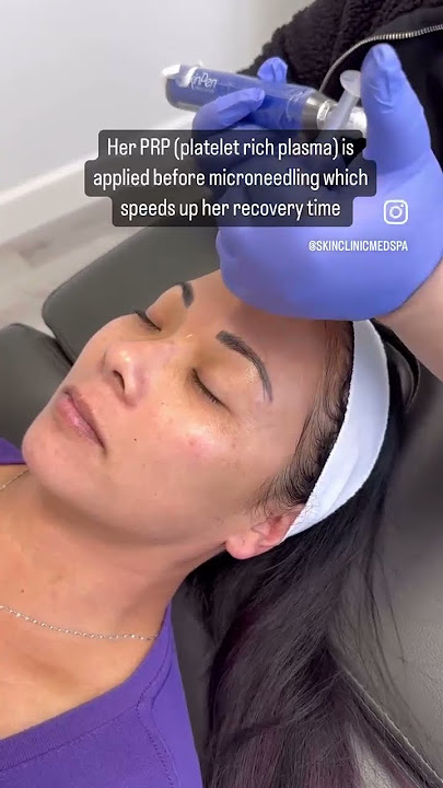 a5ddb0ccae1f4707bf18e12d389a5e47