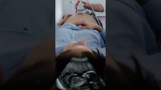 Second Trimester ultrasound ishanihealthupdate fetusdevelopment viral