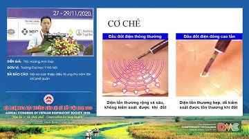 Nội soi can thiệp điều trị ung thư xâm lấn khí phế quản