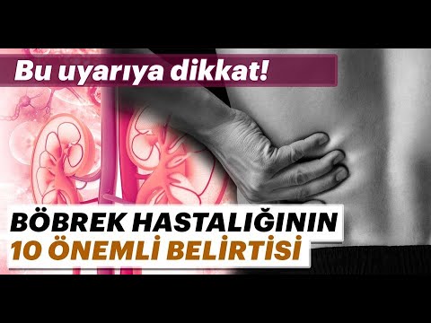 Video: Böbrek Yetmezliği Nasıl Tespit Edilir: 11 Adım (Resimlerle)