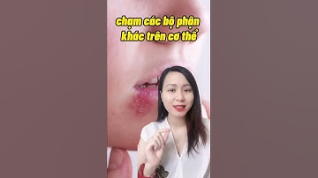 Mụn rộp ở môi hay herpes làm thế nào ? #shorts #herpesvirus  #mun