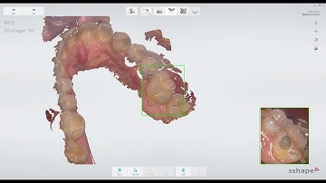 TRIOS Scan Strategy for Full Arch Impressions