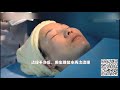 13 手打水光针 | 13 manually injected skin boosters