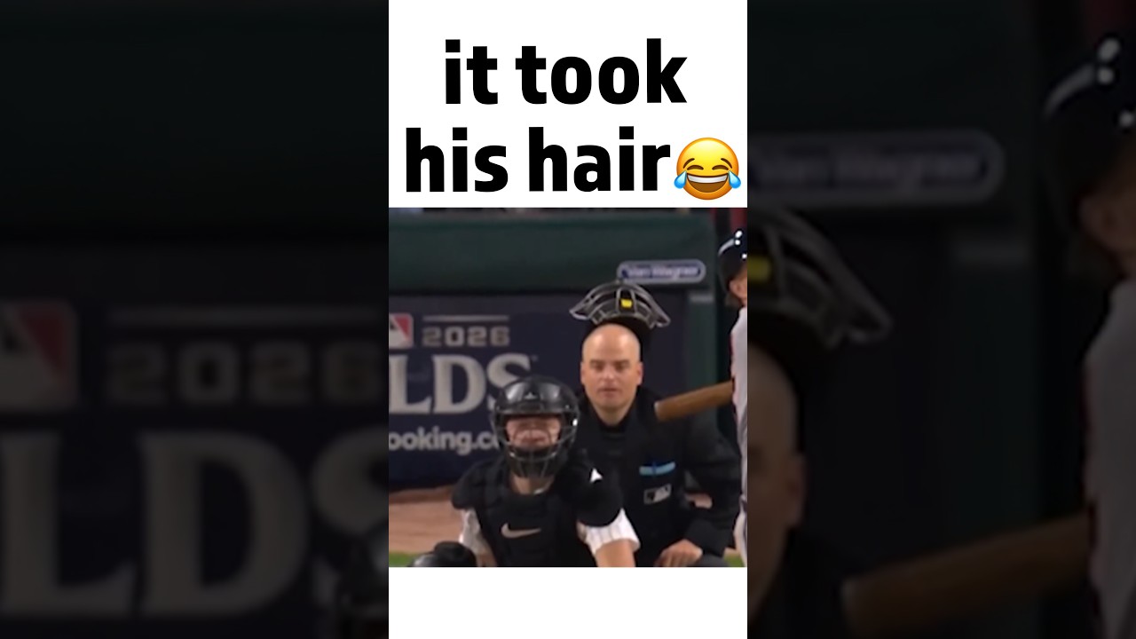 where did his hair go 😭😭