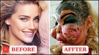 LIVE: Famous Celebrities Unrecognizable After Plastic Surgery Gone Wrong | Then and Now 2024