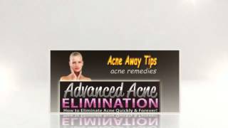 Tips To Get Rid Of Acne - Adult Acne Remedies