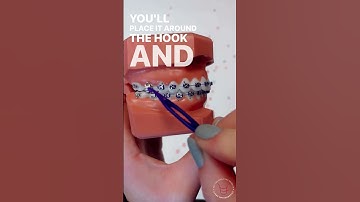 LUCAS ORTHODONTICS - HOW TO WEAR CLASS I ELASTICS