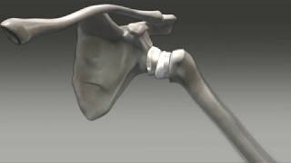 Shoulder Replacement Surgery: Exactech Equinoxe Reverse Shoulder Animation