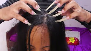 ASMR You can feel asleep Scalp Scratching with Long Nails