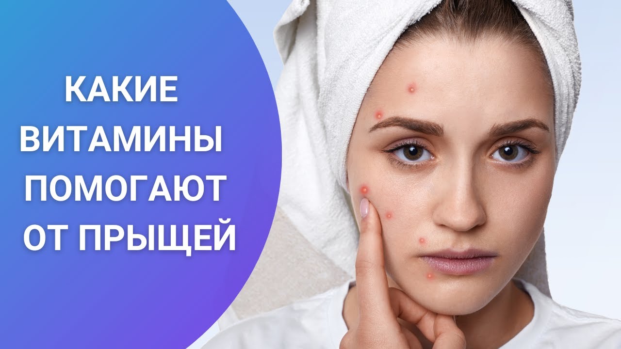 Какие витамины нужны, чтобы не было прыщей: обзор | medvisor.ru | Дзен