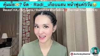 คุ้มมั๊ย💵?ฉีด💉Radi__เกือบแสนหน้าฟูแค่5วัน😭? | DOCTOR DAYDREAMER