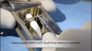 REPLICATE® Tooth replacement of both central incisors by Dr. D. Hildebrandt (short version)