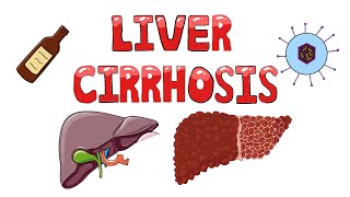 Liver Cirrhosis - What happens in Liver Cirrhosis? | Pathophysiology, Causes, Signs & Symptoms