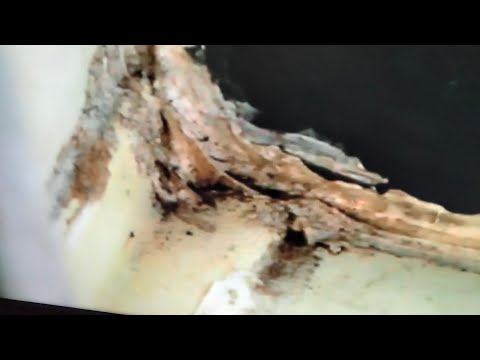 rant-nycha-farragut-houses-vacant-apartment-viewing-asbestos-abatement!!!-pt-1-of-4-10-25-17