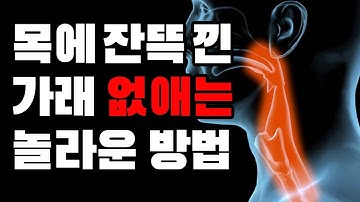 목에 잔뜩 낀 가래 없애기 가래 생기는 이유와 가래 없애는 법