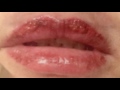 Permanent Makeup Before and After - Lip pigment, Lip Tattoo