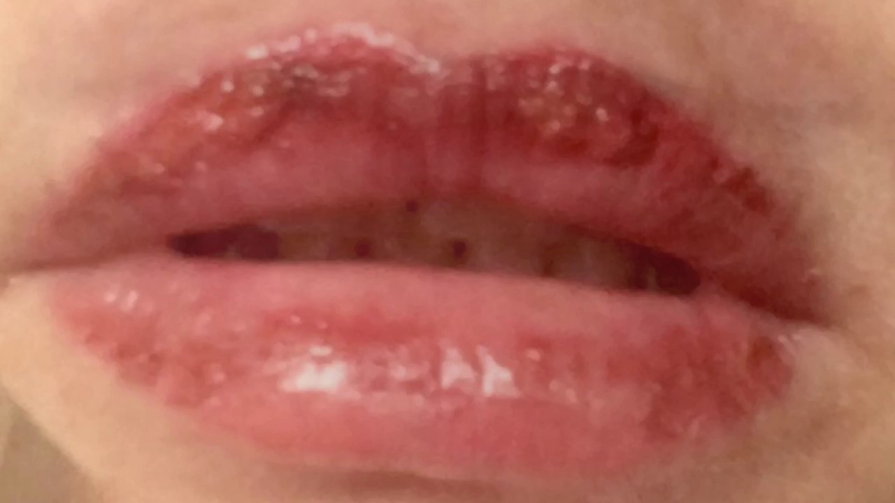 Permanent lip tattoo before and after