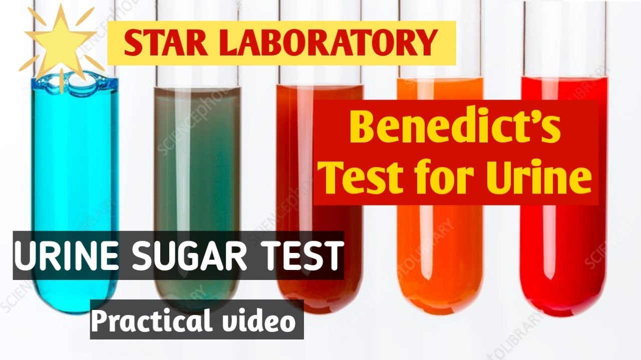 Urine for sugar test