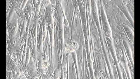 Video muscle contraction with ESCC