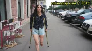 Emma amputee fourth video preview