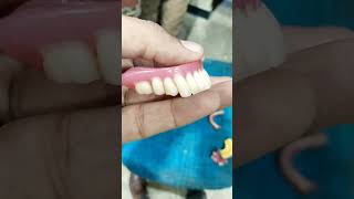 Lower Denture On Two Implants