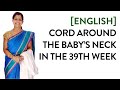 [English] - Cord around the baby's neck in the 39th week