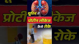 पेशाब में प्रोटीन लीकेज कैसे रोकें | Tips To Avoid Proteinuria #shorts #ytshorts #shortsfeed