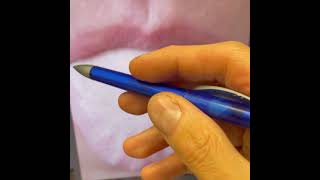 Tongue reading - swollen tongue with ridges What Would Cause The Tongue To Feel Swollen Dr Sriram Nathan