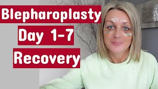 My Eye Surgery (Upper&amp;Lower blepharoplasty) / Day 1-7 Recovery