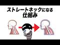 ストレートネック重症度チェック【アニメ】
