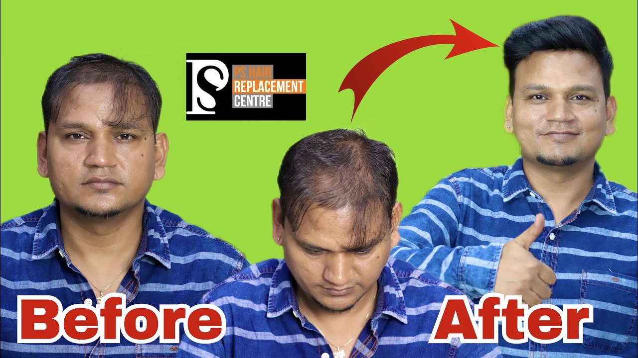 Hair Patch For Men Hair Patch Clipping System Formal Hair Style In