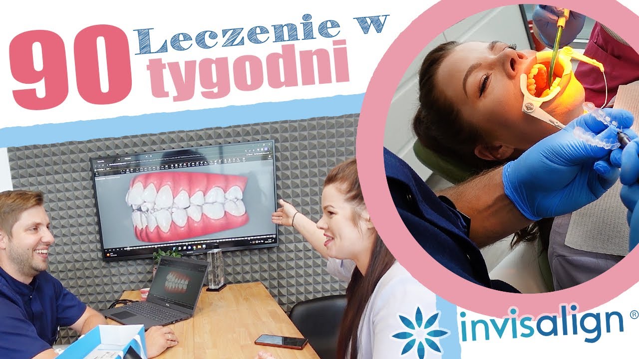 Niewidoczny aparat. CZY TO BOLI? Jak wygląda założenie aparatu ortodontycznego invisalign