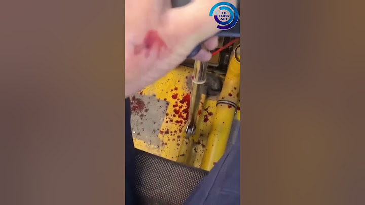 Uçağın Camına Çarpan Kuş Pilotu Yaraladı