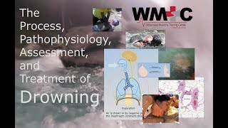 The Process, Pathophysiology, Assessment, and Treatment of Drowning