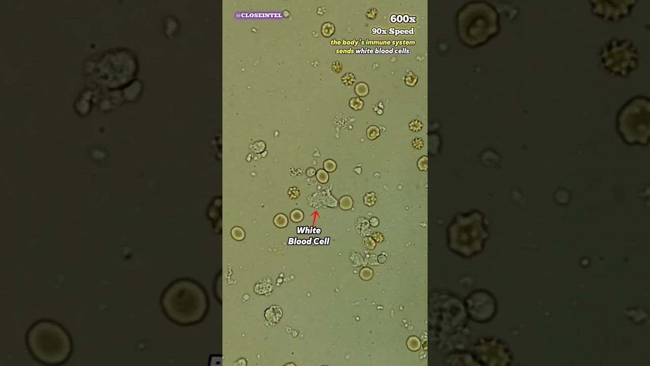 Прыщ под микроскопом