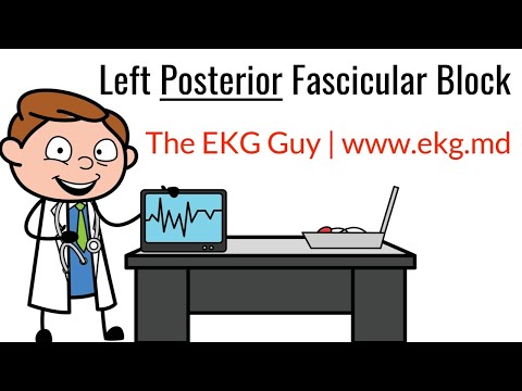 left-posterior-fascicular-block-on-ekg-/-ecg-l-the-ekg-guy---www.ekg.md